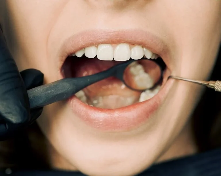 Wybielanie zębów: Czy warto zainwestować?