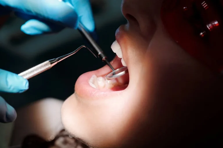 Piaskowanie zębów – co warto wiedzieć o kosztach tego zabiegu?